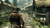 The Elder Scrolls V: Skyrim Anniversary Upgrade (DLC) XBOX LIVE Key TURKEY for sale